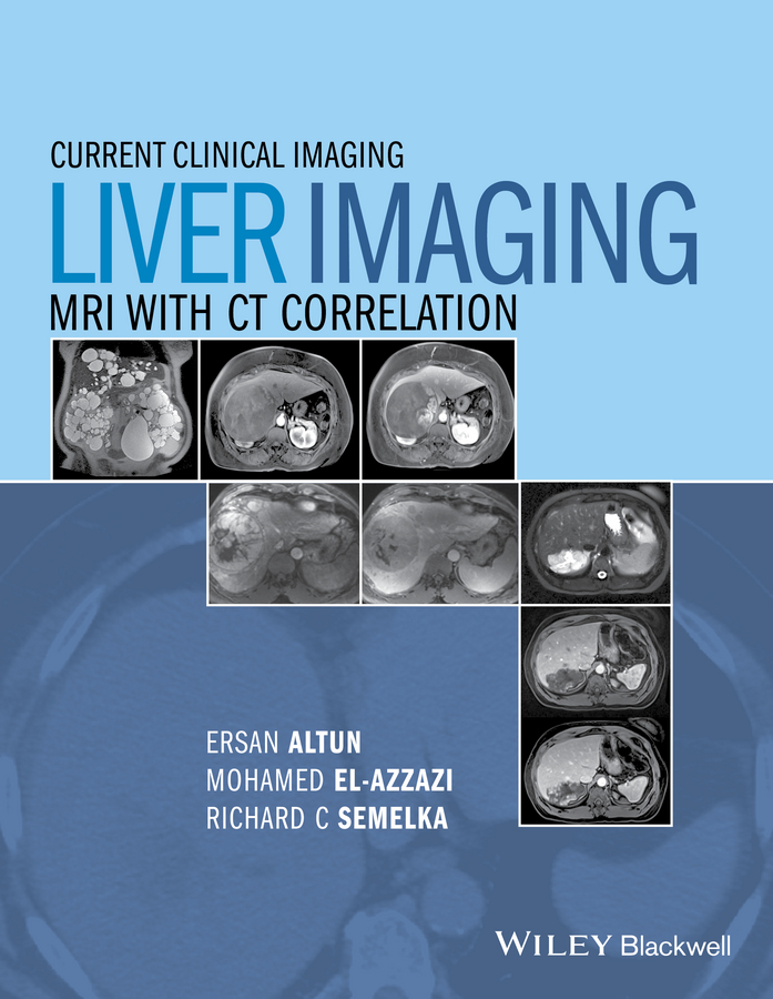 Altun, Ersan - Liver Imaging: MRI with CT Correlation, ebook