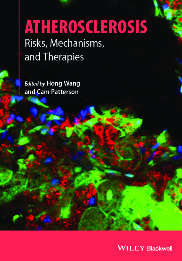 Patterson, Cam - Atherosclerosis: Risks, Mechanisms, and Therapies, e-bok