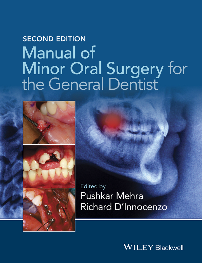 D'Innocenzo, Richard - Manual of Minor Oral Surgery for the General Dentist, e-kirja
