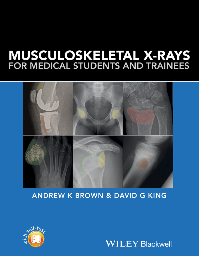 Brown, Andrew - Musculoskeletal X-Rays for Medical Students and Trainees, ebook