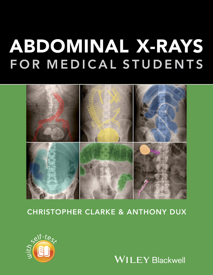 Clarke, Christopher - Abdominal X-rays for Medical Students, e-bok