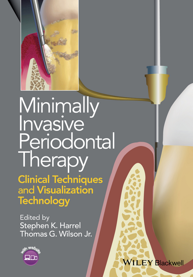 Harrel, Stephen K. - Minimally Invasive Periodontal Therapy: Clinical Techniques and Visualization Technology, ebook