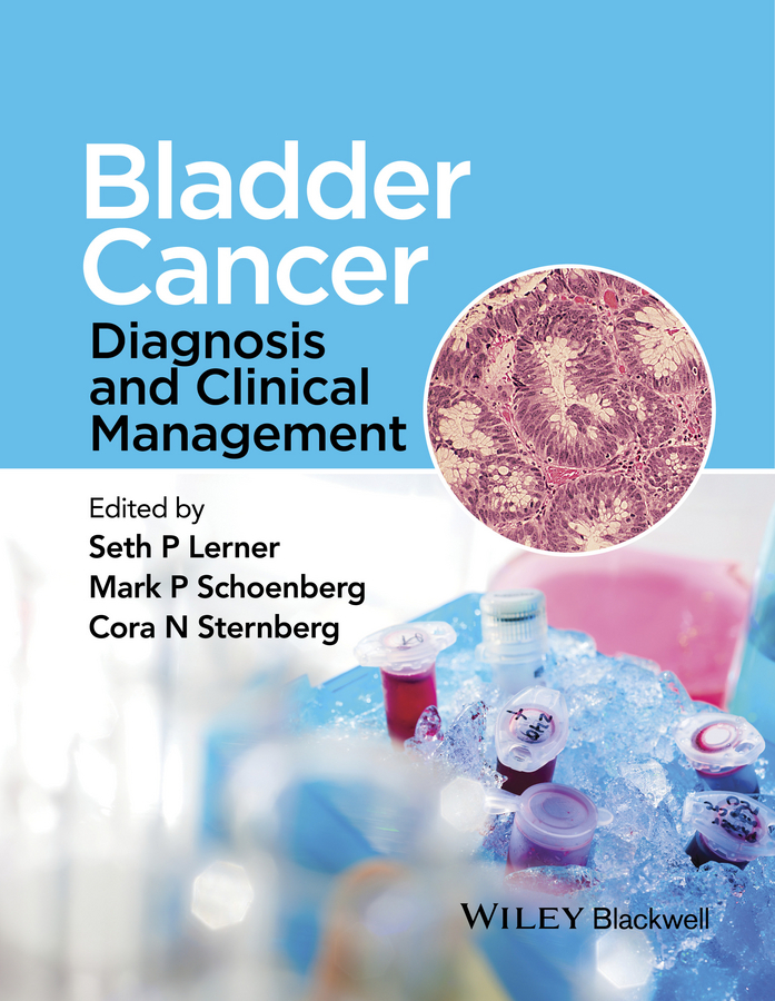 Lerner, Seth - Bladder Cancer: Diagnosis and Clinical Management, e-bok