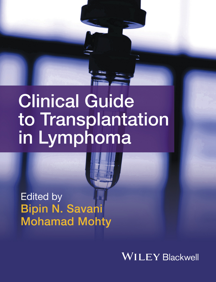 Mohty, Mohamad - Clinical Guide to Transplantation in Lymphoma, e-kirja