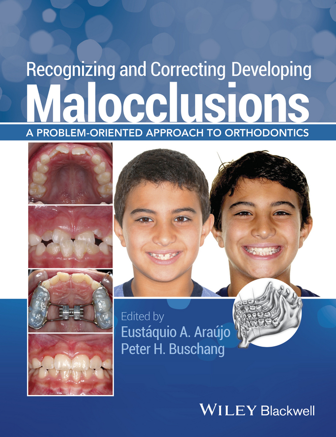Araújo, Eustáquio A. - Recognizing and Correcting Developing Malocclusions: A Problem-Oriented Approach to Orthodontics, ebook