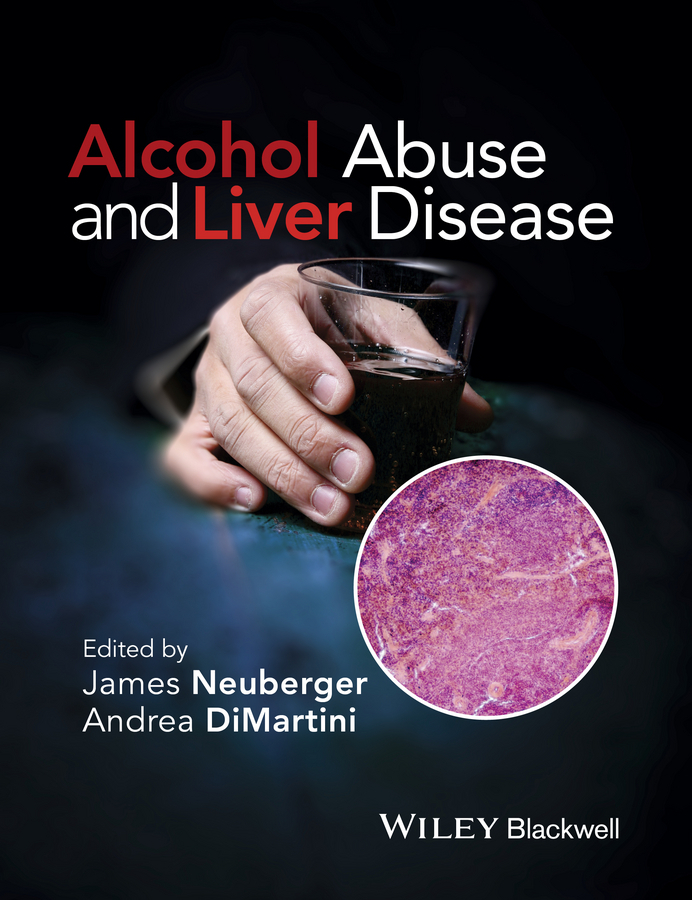 DiMartini, Andrea - Alcohol Abuse and Liver Disease, e-bok
