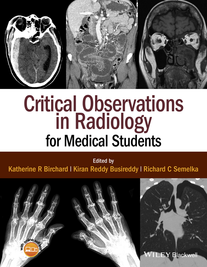 Birchard, Katherine R. - Critical Observations in Radiology for Medical Students, e-bok
