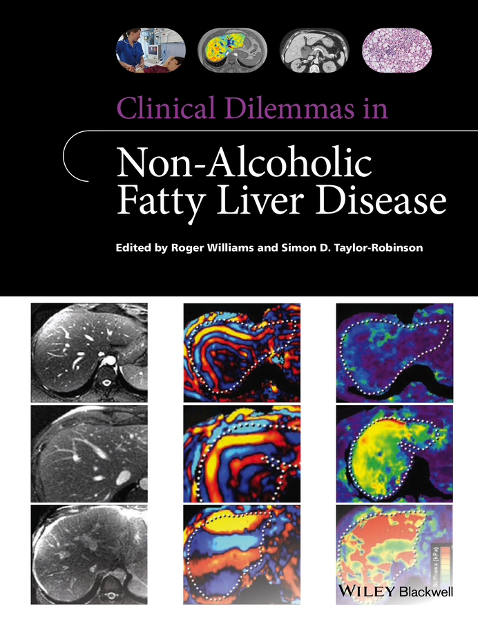 Taylor-Robinson, Simon D. - Clinical Dilemmas in Non-Alcoholic Fatty Liver Disease, e-bok