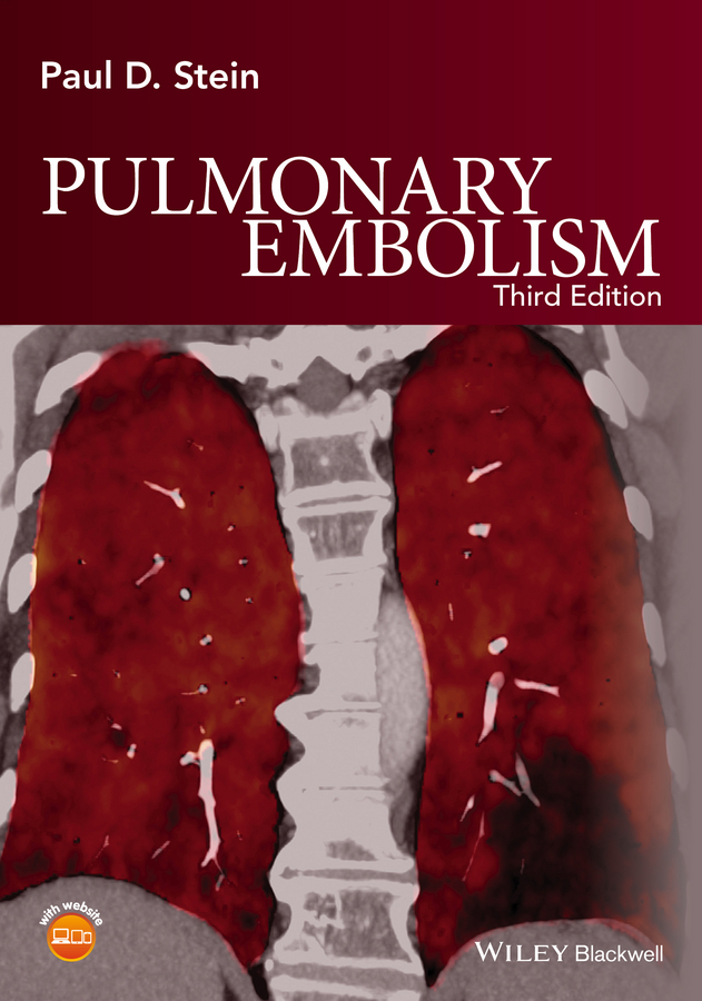 Stein, Paul D. - Pulmonary Embolism, e-kirja