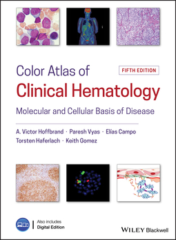 Campo, Elias - Color Atlas of Clinical Hematology: Molecular and Cellular Basis of Disease, ebook