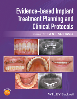 Sadowsky, Steven J. - Evidence-based Implant Treatment Planning and Clinical Protocols, ebook