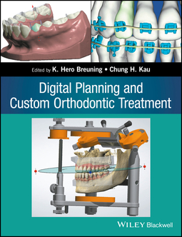 Breuning, K. Hero - Digital Planning and Custom Orthodontic Treatment, e-kirja
