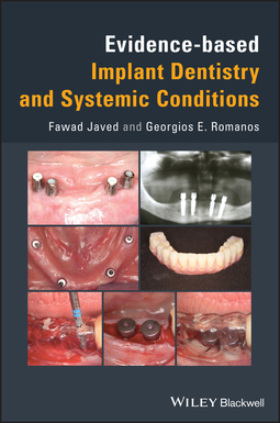 Romanos, Georgios E. - Evidence-based Implant Dentistry and Systemic Conditions, ebook