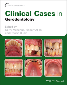 Allen, Finbarr - Clinical Cases in Gerodontology, ebook