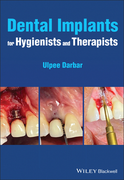 Darbar, Ulpee R. - Dental Implants for Hygienists and Therapists, ebook