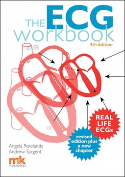 Rowlands, Angela - The ECG Workbook, e-bok